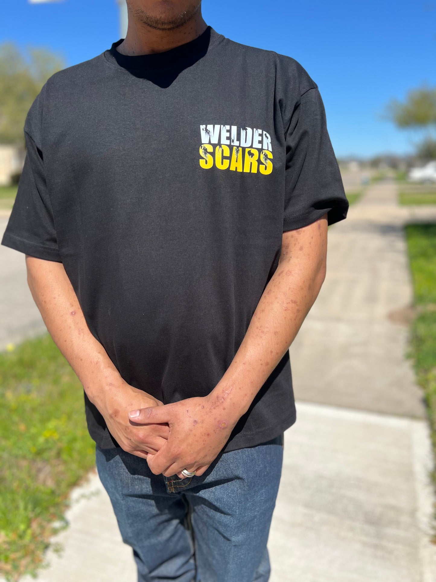 Welder Scars